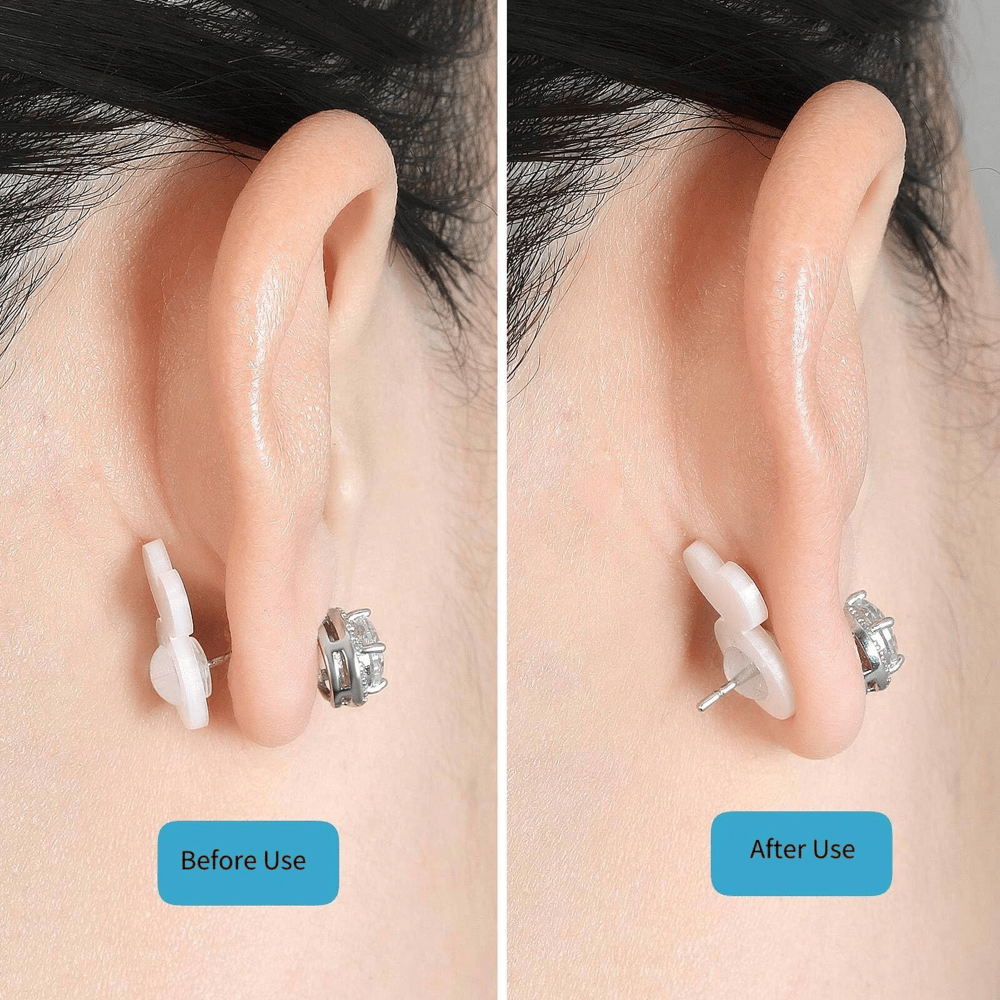 🔥2025 New Earring Lifters