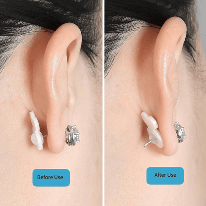 🔥2025 New Earring Lifters